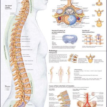 Human Spine Disorders Anatomical Chart - Soft Laminate