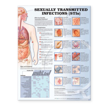 Sexually Transmitted Infections Anatomical Chart - Soft Laminate