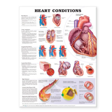 Heart Conditions - Soft Laminate