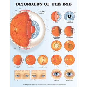 Disorders of the Eye Anatomical Chart – Soft Laminate