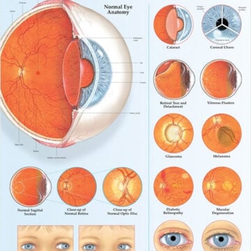 Disorders of the Eye Anatomical Chart - Soft Laminate