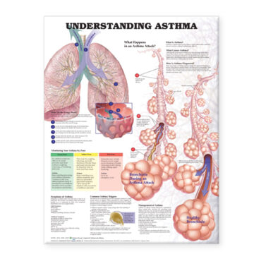 Understanding Asthma Anatomical Chart - Soft Laminate