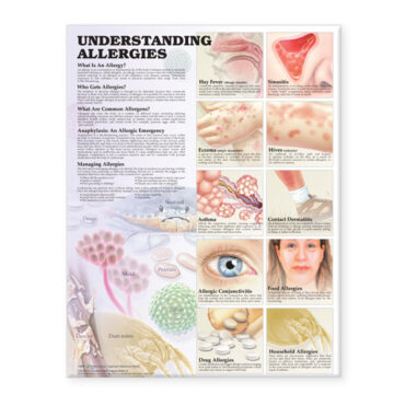 Understanding Allergies Anatomical Chart - Soft Laminate