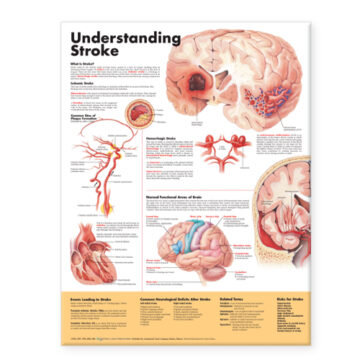 Understanding Stroke Anatomical Chart - Soft Laminate