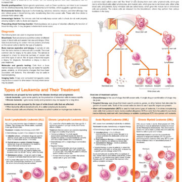 Understanding Leukemia Anatomical Chart - Soft Laminate