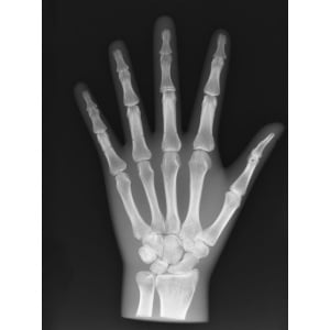 X-Ray Phantom Hand, opaque