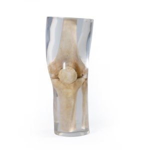 X-Ray Phantom Knee, transparent