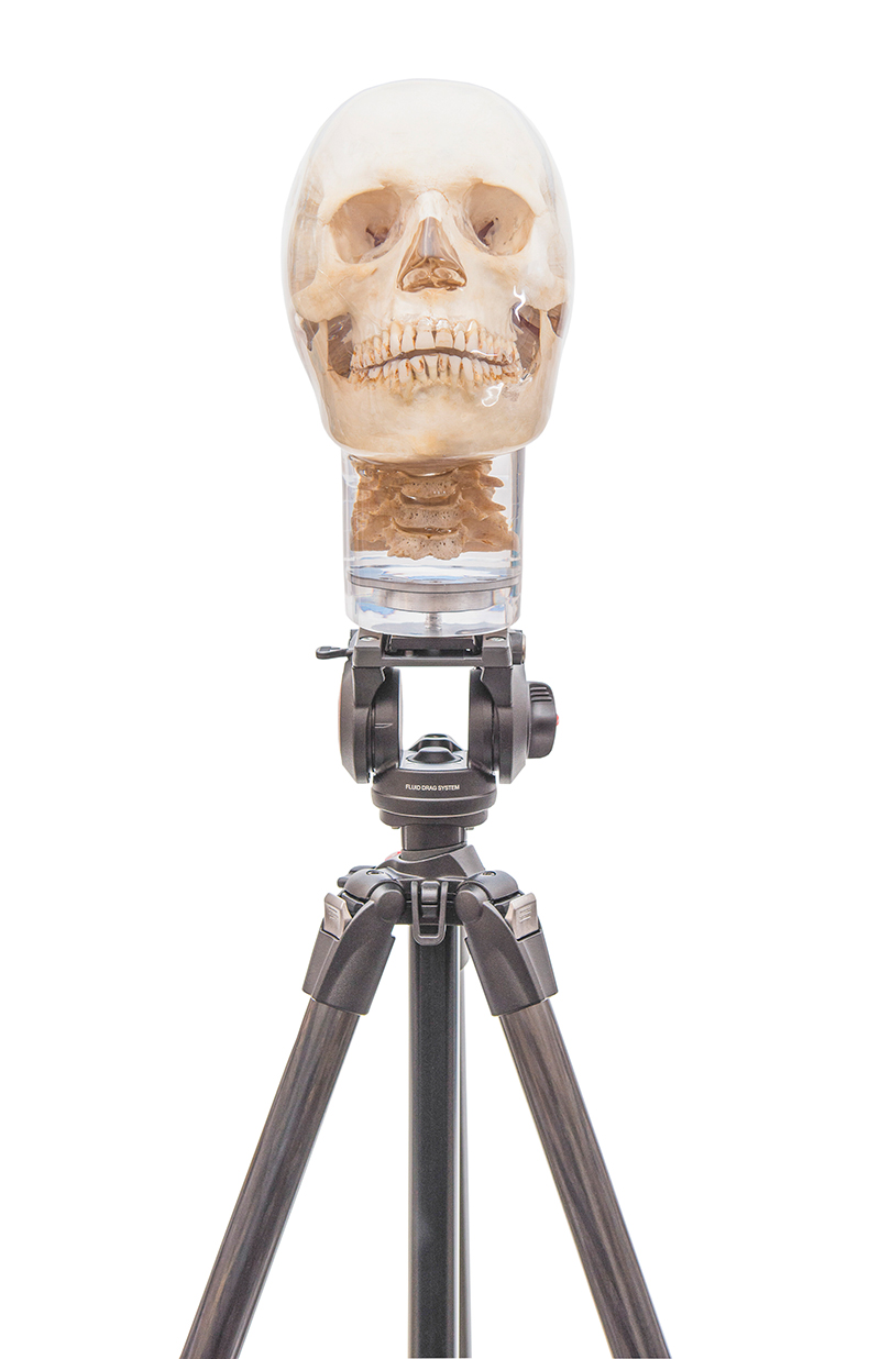 Tripod for X-ray Phantom Head - 2