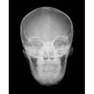 Sectional X-ray phantom with artificial bones – Head phantom, transparent