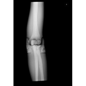 Sectional X-ray phantom with artificial bones – Right Elbow, opaque