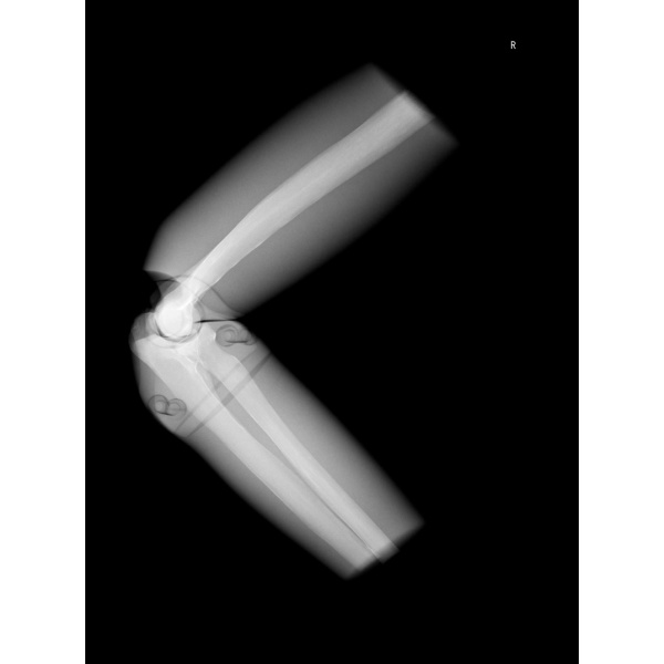 Sectional Xray phantom with artificial bones Right Elbow, opaque