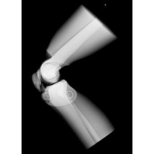 Sectional X-ray phantom with artificial bones – Right Knee, opaque