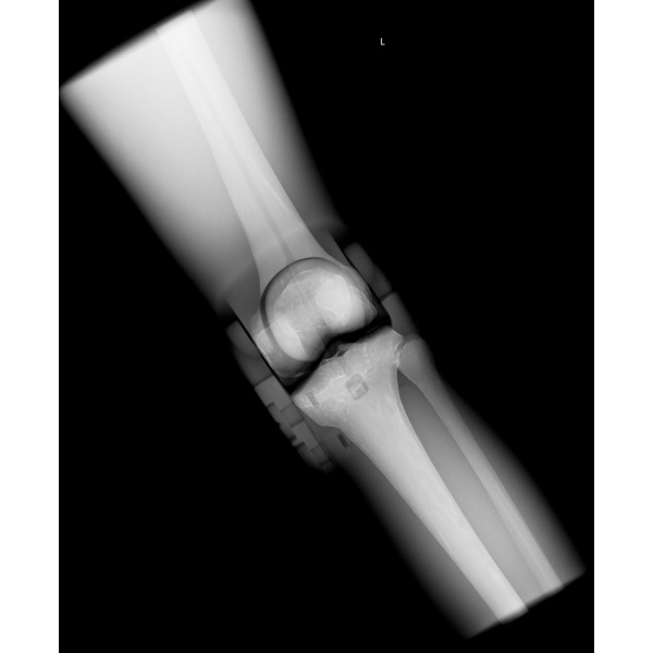 Sectional Xray phantom with artificial bones Right Knee, opaque