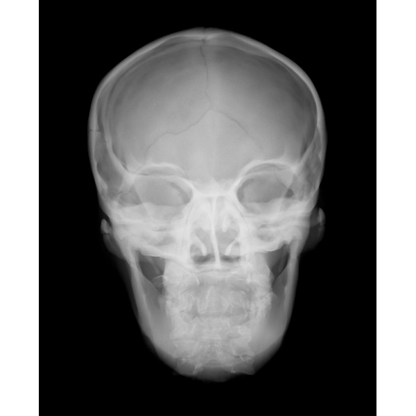 Sectional Xray Phantom with Artificial Bones Head Phantom, opaque
