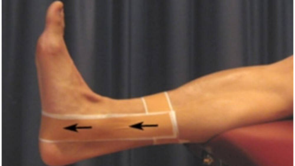 Strapping For Injuries Sports Medicine & Rehabilitation Education - Australian Physiotherapy ...