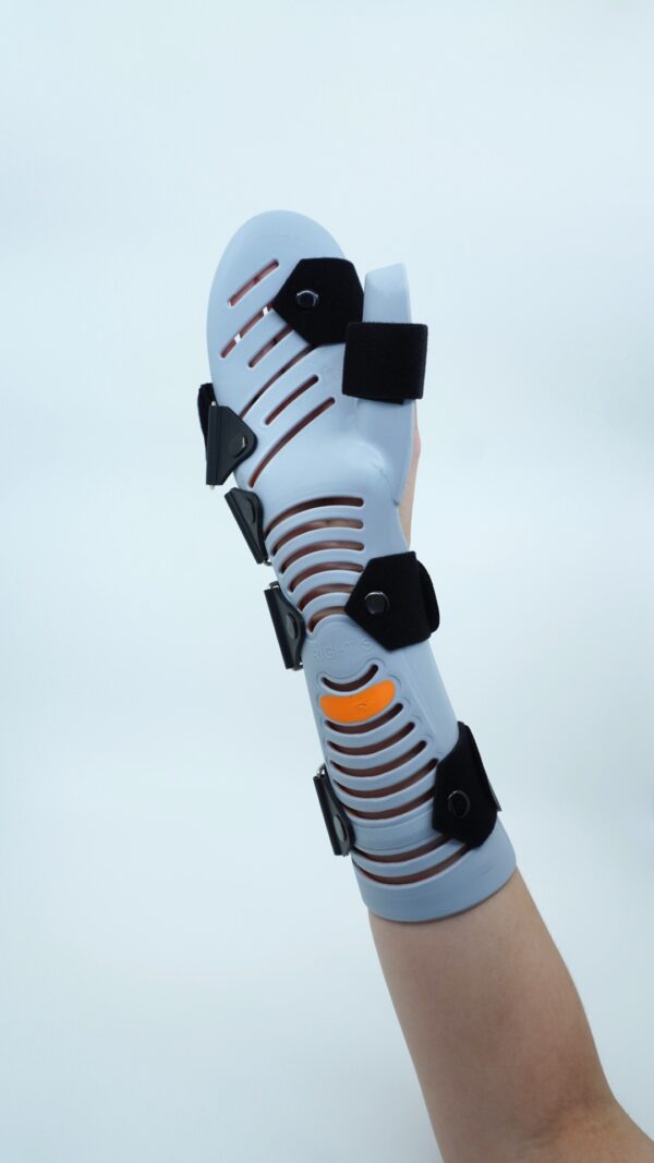 Supporta Static Hand Splint - Australian Physiotherapy Equipment