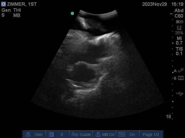9100_10_800x800 Ultrasound image of a baby in black and white