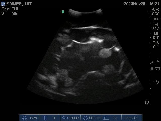 9100_11_800x800 Black image showing ultrasound effect