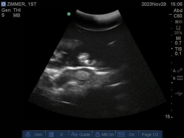 9100_12_800x800 Ultrasound image