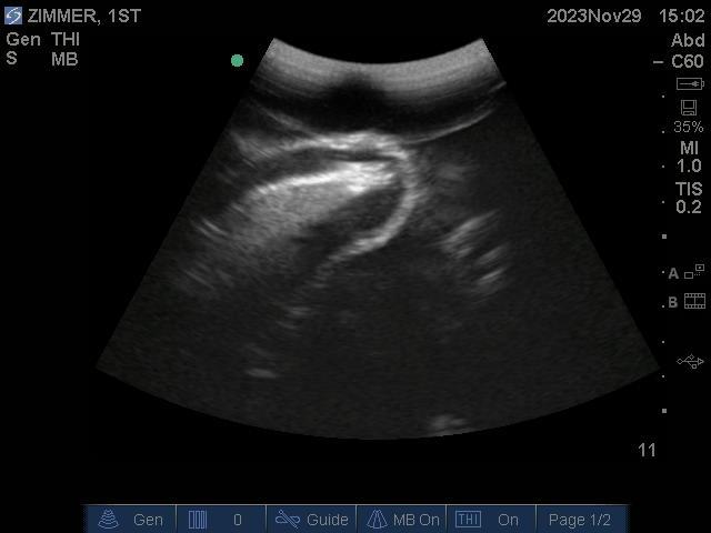 9100_13_800x800 Ultrasound image of a baby in the womb