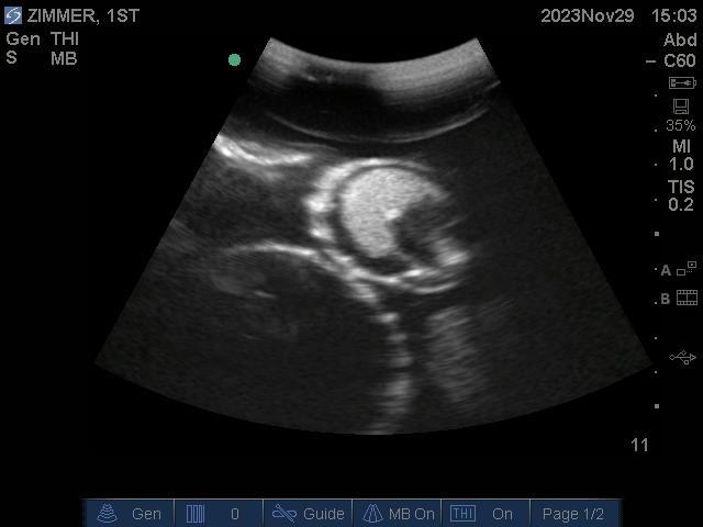 9100_14_800x800 Ultrasound image of a baby displayed on a computer screen