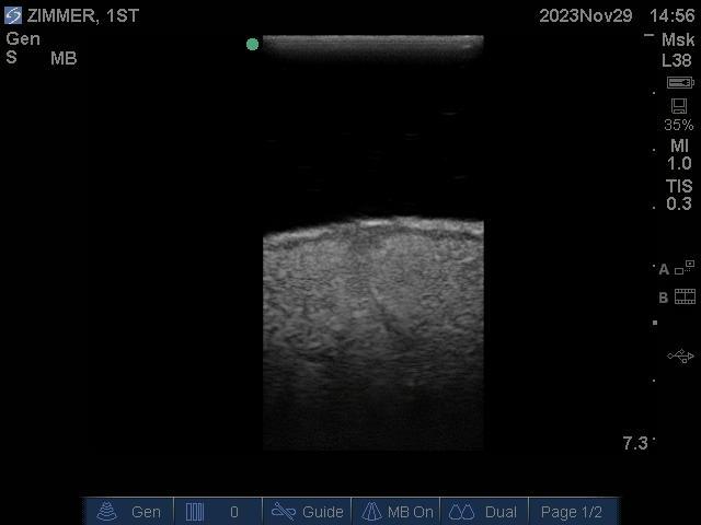 9100_6_800x800 Monochrome ultrasound