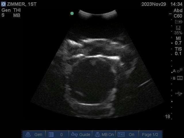 9100_7_800x800 Black ultrasound image of baby's head