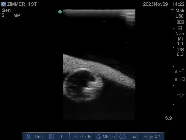 9100_8_800x800 Black and white ultrasound scan of a baby