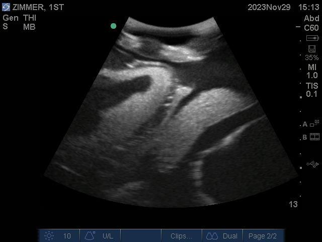 9100_9_800x800 Monochrome ultrasound picture of a baby