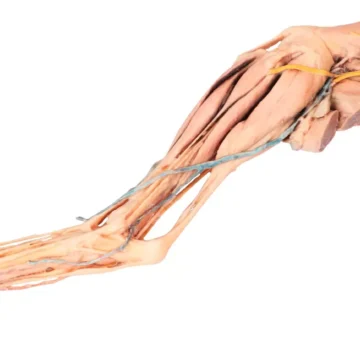 Dog hindlimb - muscles, tendons, ligaments, vessels and nerves distal to the stifle