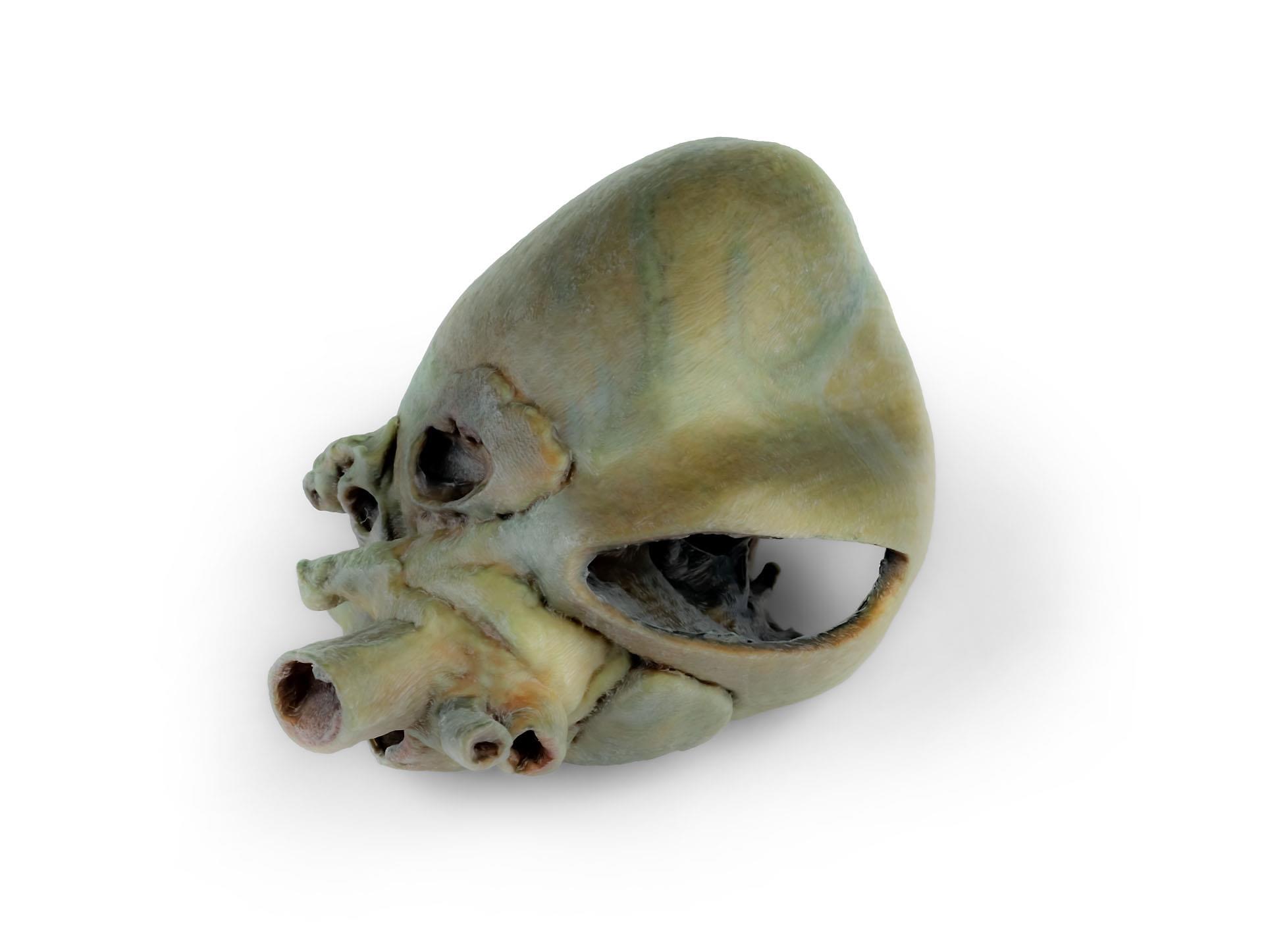 Canine heart with dissection Canine heart with dissection
