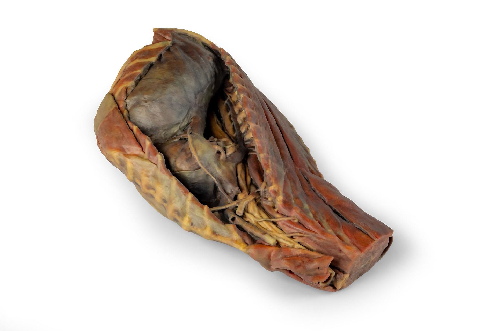 Canine Thoracic Cavity Canine Thoracic Cavity