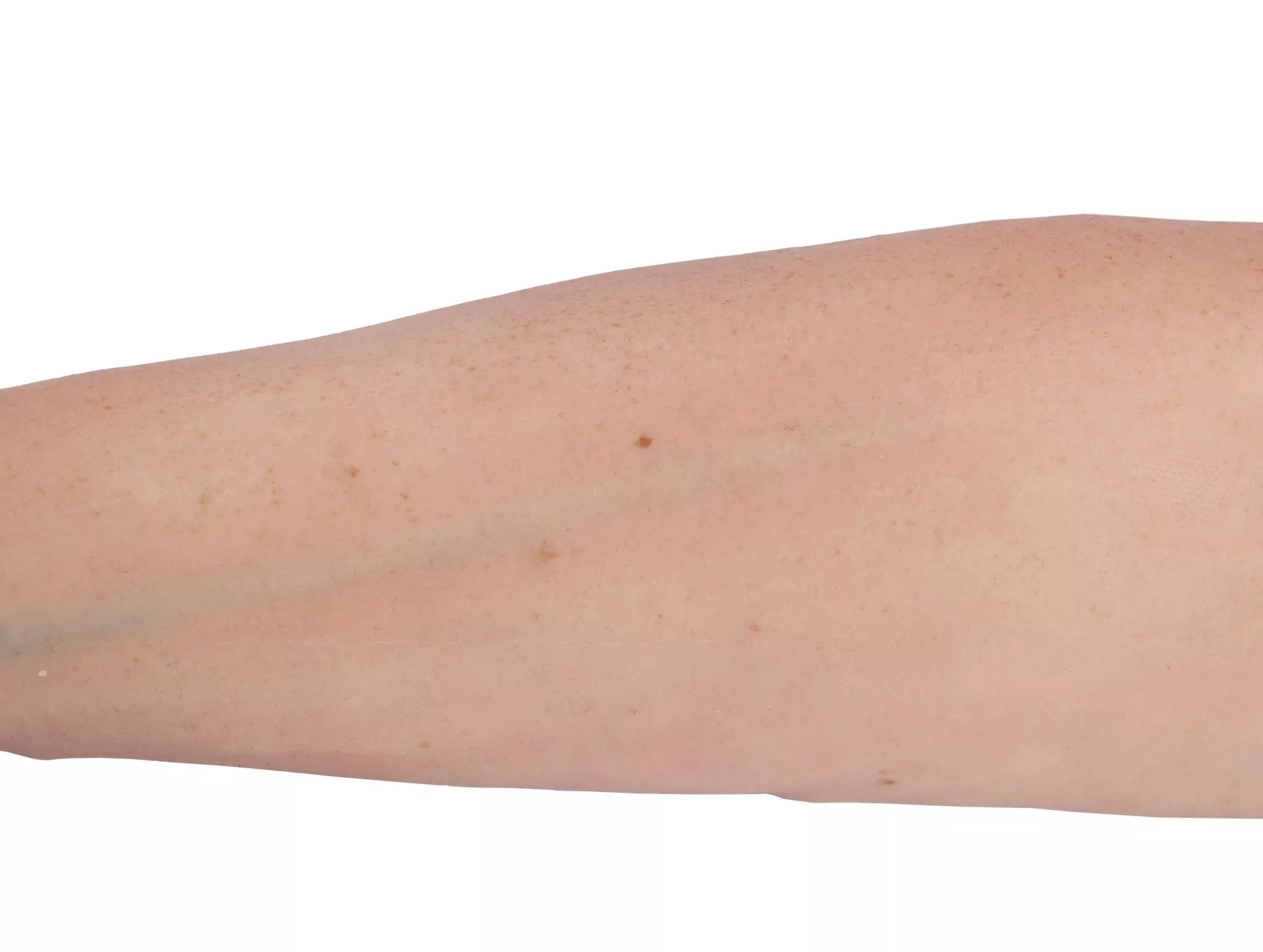 Puncture Pete – hyperrealistic IV training arm, light skin color Puncture Pete – hyperrealistic IV training arm, light skin color
