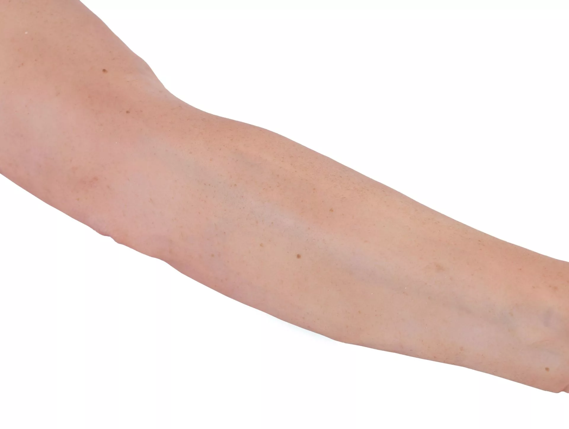 Puncture Pete – hyperrealistic IV training arm, light skin color Puncture Pete – hyperrealistic IV training arm, light skin color