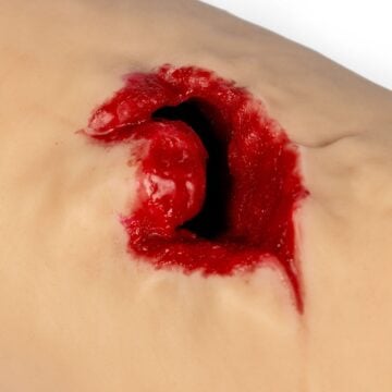 “Bill” Wound Packing Trainer with Bone Fragments