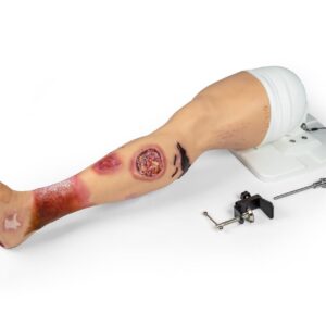 “Lena Leg” – Leg with medical conditions