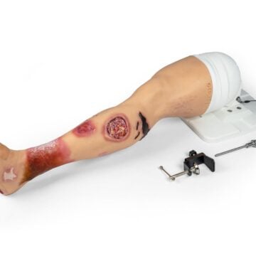 "Lena Leg" - Leg with medical conditions