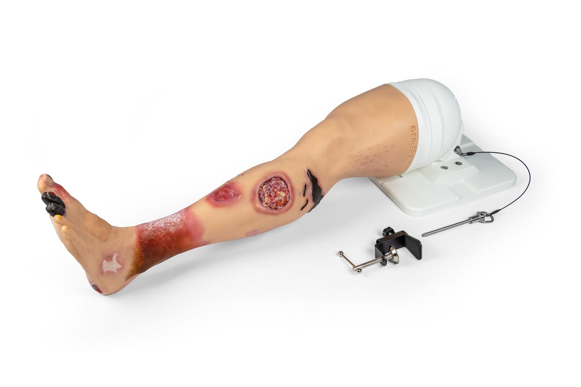 "Lena Leg" - Leg with medical conditions "Lena Leg" - Leg with medical conditions