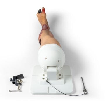 "Lena Leg" - Leg with medical conditions