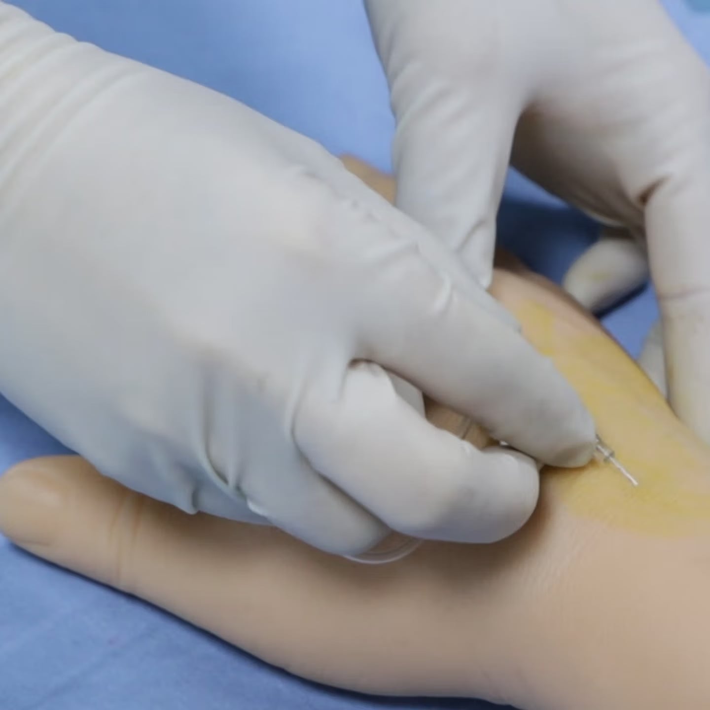 DS-20612 - Advanced Arterial Puncture Training Arm Advanced Arterial Puncture Training Arm