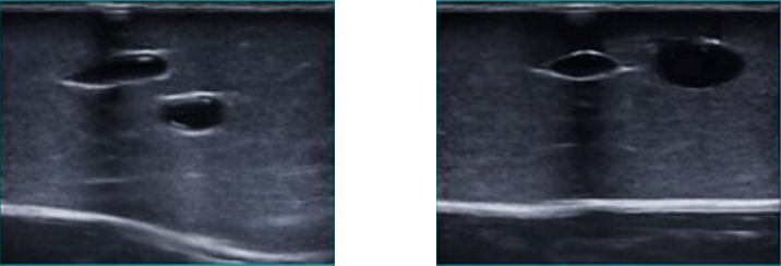 DS-40201 - Ultrasound-Guided Vascular Access Training Model Ultrasound-Guided Vascular Access Training Model