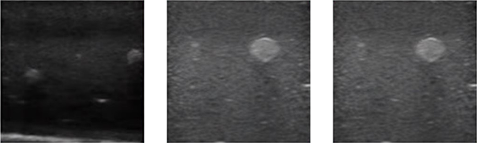 DS-40202 - Ultrasound-Guided Nerve Block Training Model Ultrasound-Guided Nerve Block Training Model