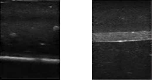 DS-40202 - Ultrasound-Guided Nerve Block Training Model Ultrasound-Guided Nerve Block Training Model