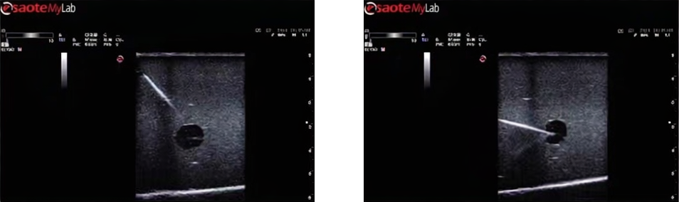 DS-40203 - Breast Ultrasound-Guided Biopsy Training Model Breast Ultrasound-Guided Biopsy Training Model