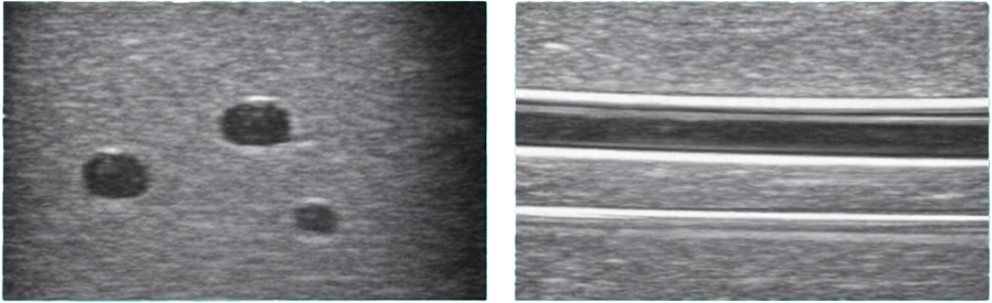 DS-40204 - Ultrasound-Guided Puncture Model – Forearm Venipuncture Training Ultrasound-Guided Puncture Model – Forearm Venipuncture Training