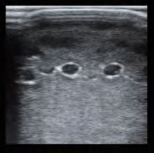 DS-40301 - Ultrasound-Guided Radial Artery Puncture Model Ultrasound-Guided Radial Artery Puncture Model