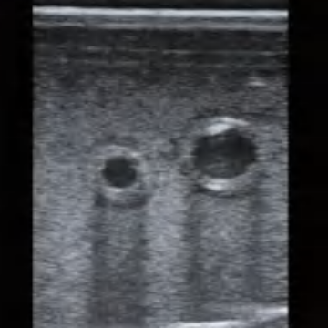 Ultrasound-Guided Femoral Artery Puncture Model