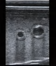 DS-40302 - Ultrasound-Guided Femoral Artery Puncture Model Ultrasound-Guided Femoral Artery Puncture Model