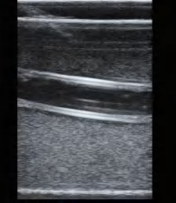 DS-40302 - Ultrasound-Guided Femoral Artery Puncture Model Ultrasound-Guided Femoral Artery Puncture Model