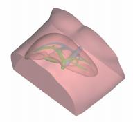 DS-40303 - Ultrasound-Guided Liver Puncture Model Ultrasound-Guided Liver Puncture Model